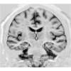 i-module_neurologie